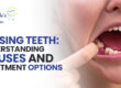 Missing Teeth: Understanding Causes and Treatment options