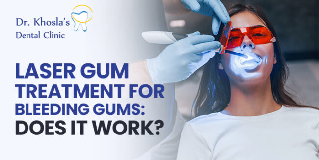Laser Gum Treatment Laser Gum Treatment