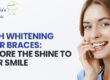 Teeth Whitening After Braces