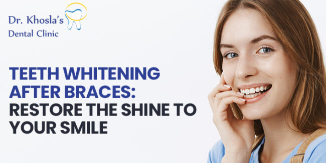 Teeth Whitening After Braces Teeth Whitening After Braces