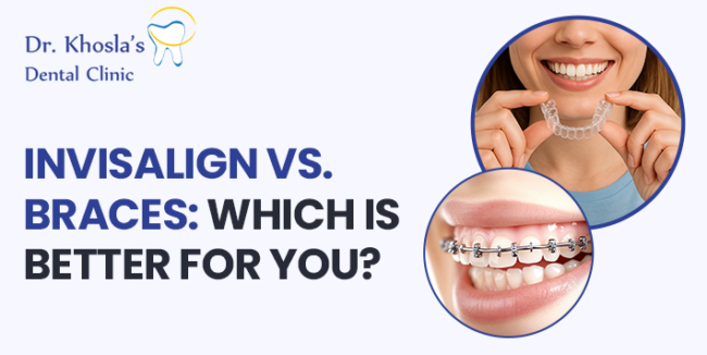 Invisalign vs Braces Invisalign vs Braces