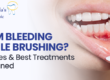 gum bleeding causes treatment