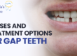 Gap Teeth