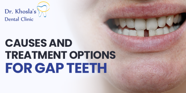 Gap Teeth Gap Teeth