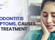 periodontitis symptoms