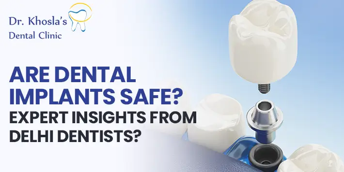 are-dental-implants-safe-delhi