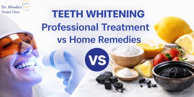 1-Teeth Whitening_ Professional Treatment vs Home Remedies