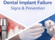 dental implant failure