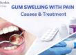 Gum Swelling with Pain