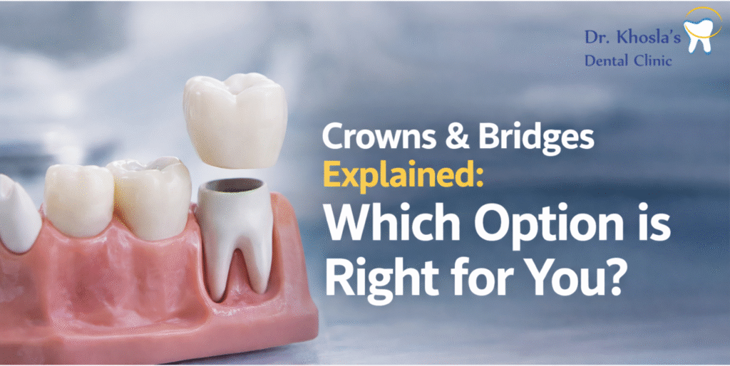 Crowns & Bridges