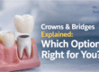 Crowns & Bridges
