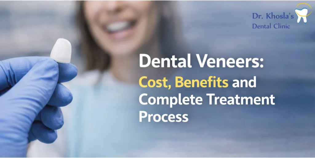 Dental Veneers: Cost, Benefits, and Complete Treatment Process