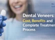 Dental Veneers: Cost, Benefits, and Complete Treatment Process
