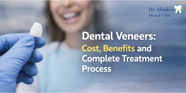 Dental Veneers_ Cost, Benefits and Complete Treatment Process Dental Veneers: Cost, Benefits, and Complete Treatment Process